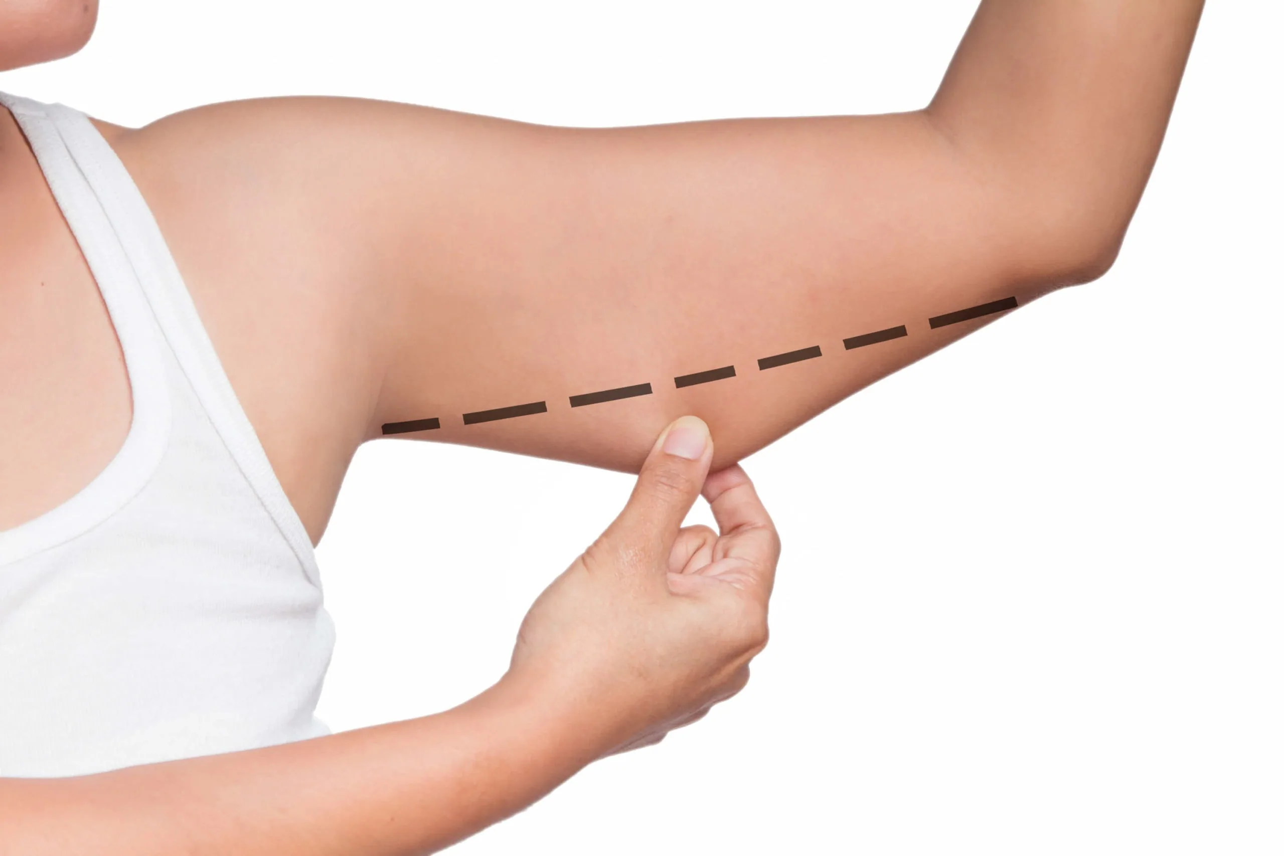 Braquioplastia malaga
