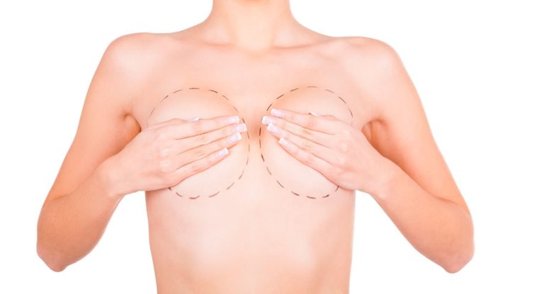 ¿Cómo detectar las mamas tubulares?