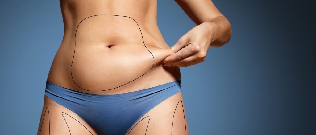 Liposuccion malaga abdomen