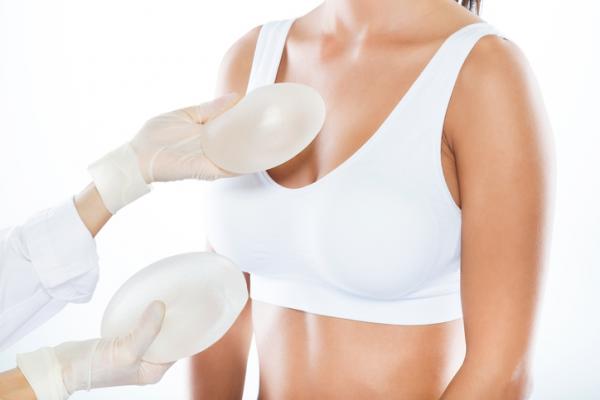 5 razones para hacerte una mamoplastia de aumento
