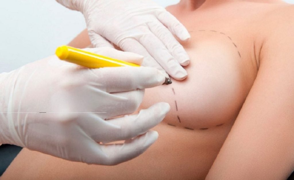 Mamas Recons | Dr. César Padilla, Málaga