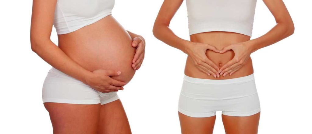 Mommy makeover sevilla