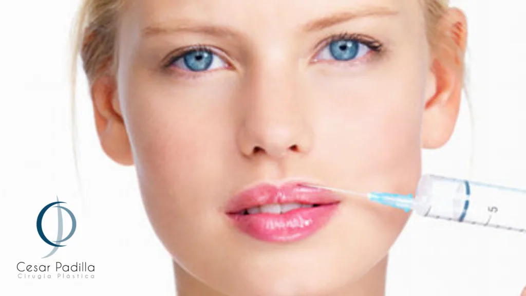 Aumento Labios Cesar Padilla Estetica | Dr. César Padilla, Málaga