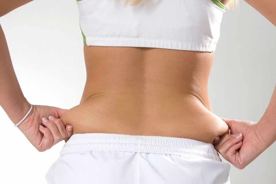Liposuccion Malaga Flancos | Dr. César Padilla