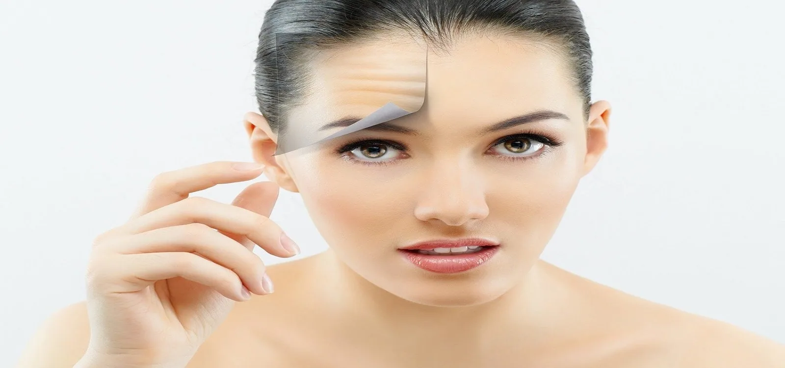 Tratamiento botox