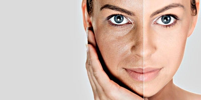Rejuvenecimiento Facial Antes Despues | Dr. César Padilla, Málaga