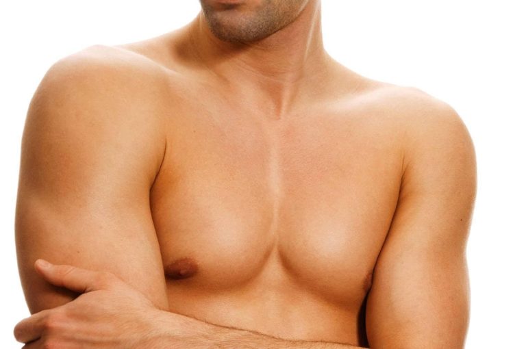 Ginecomastia: ¿cómo tratar el trastorno mamario masculino?