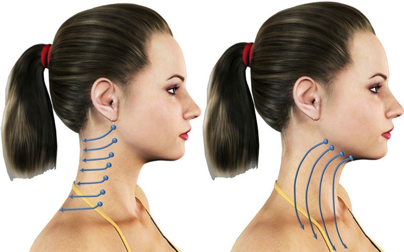 Lifting Cuello Dr Padilla Tecnica | Dr. César Padilla, Málaga