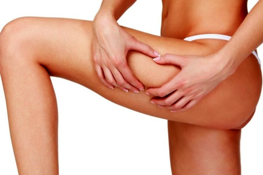Adios Celulitis | Dr. César Padilla, Málaga