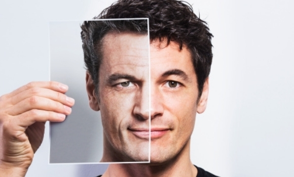 Blafaroplastia Cesar Padilla | Dr. César Padilla, Málaga
