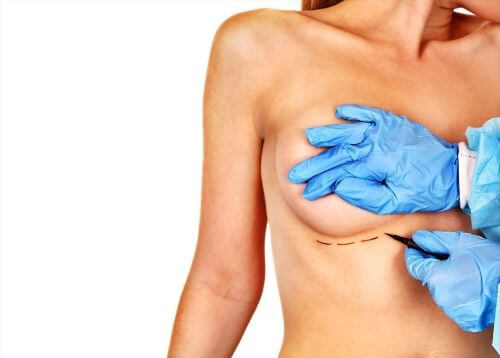Incision mama