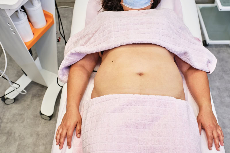 ¿Cómo eliminar el exceso de piel en el abdomen de forma definitiva? en Málaga | Dr. César Padilla