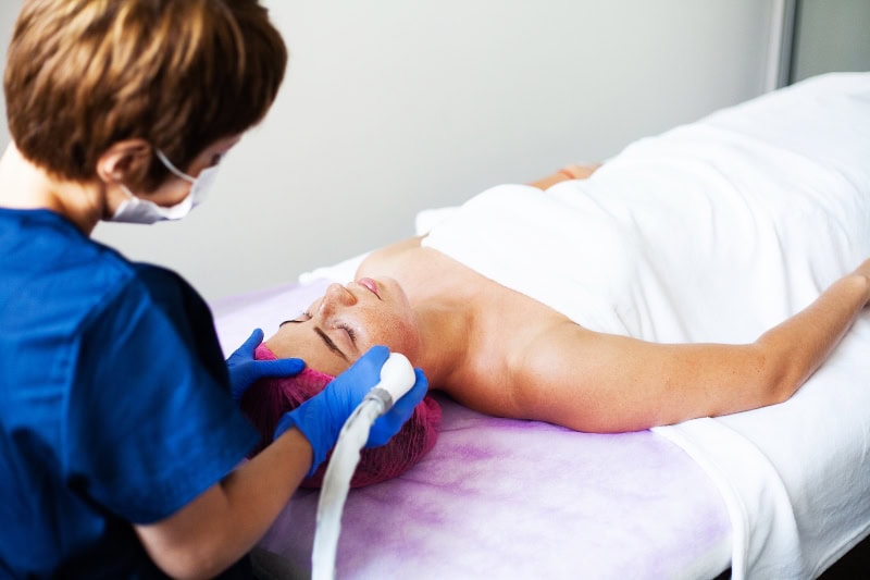 Rejuvenecimiento facial con láser: descubre cómo el Láser Fractora transforma tu piel en Málaga | Dr. César Padilla