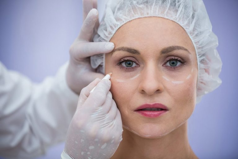 Adiós a las Bolsas Bajo los Ojos: Cómo la Blefaroplastia Puede Transformar tu Mirada