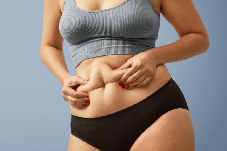 ¿Qué es la diástasis abdominal y cómo se corrige? Todo lo que debes saber si te afecta