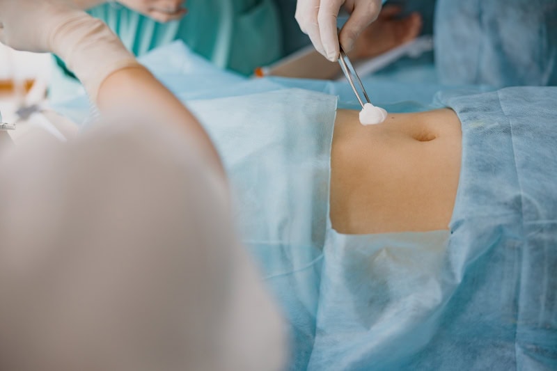 Diástasis abdominal en hombres: ¿cómo afecta y qué soluciones existen? en Málaga | Dr. César Padilla