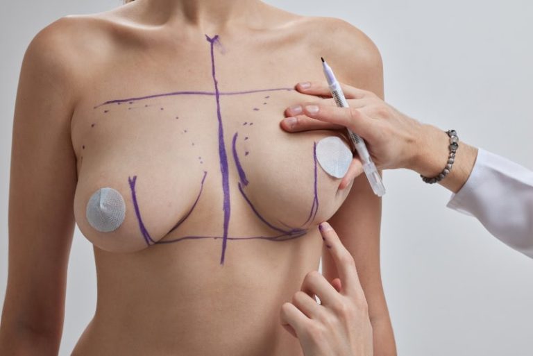 ¿Es normal tener un seno más grande que el otro? Causas y soluciones médicas