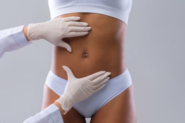 Abdomen operado: ¿cómo es el resultado, cicatrices y recuperación tras una abdominoplastia