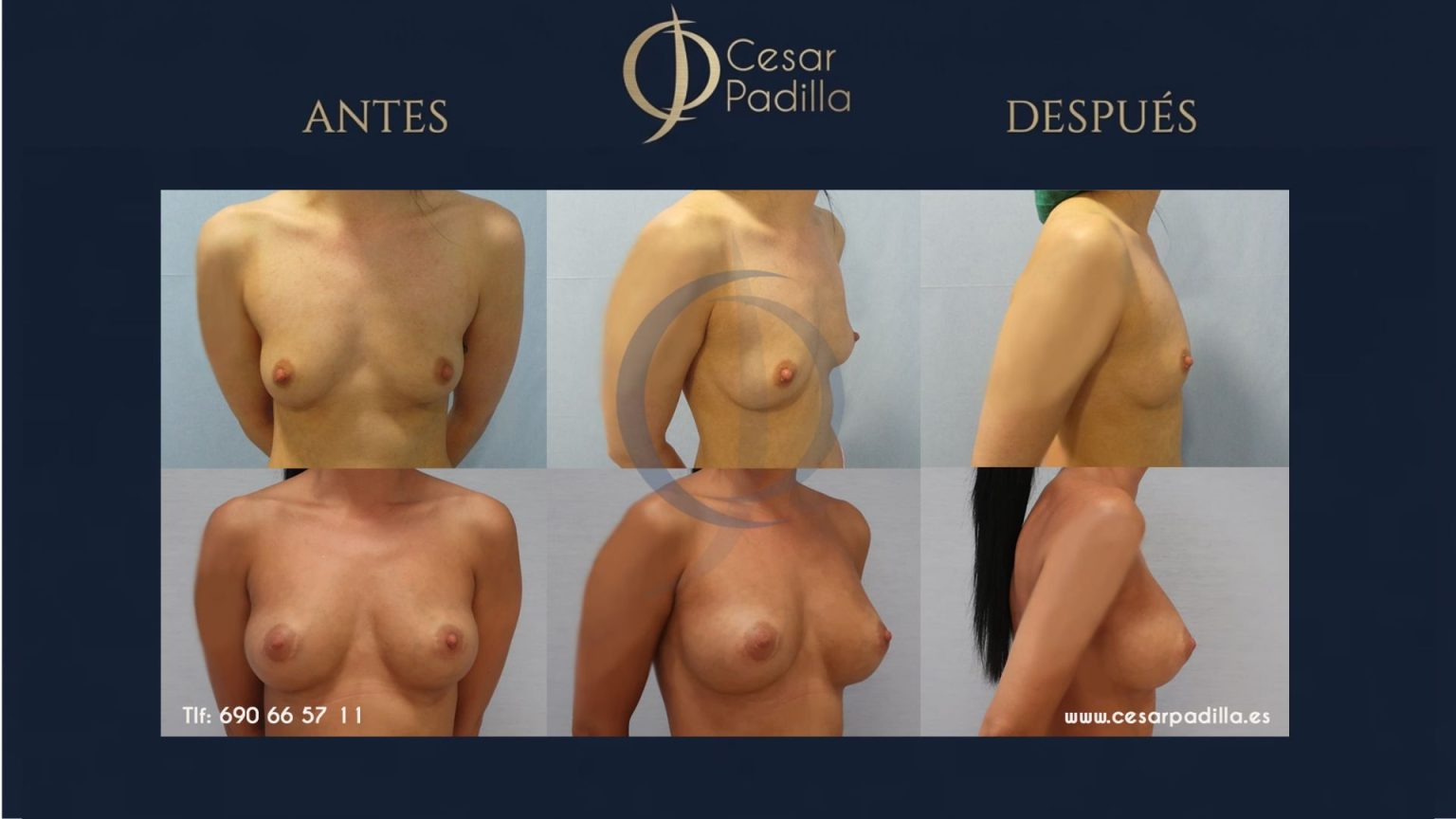 Dr. César Padilla — Cirugía Plástica y Estética en Málaga