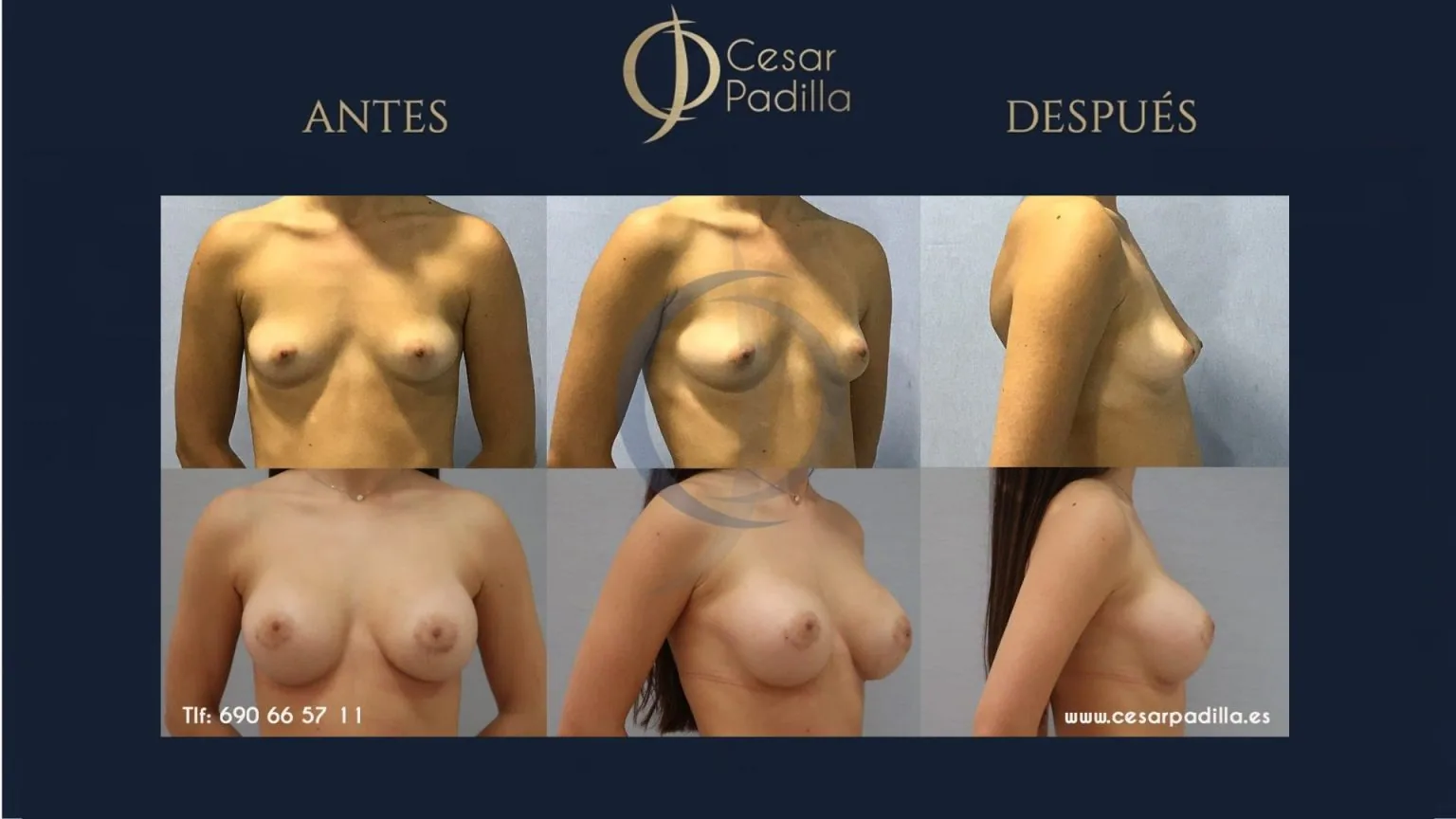 Dr. César Padilla — Cirugía Plástica y Estética en Málaga
