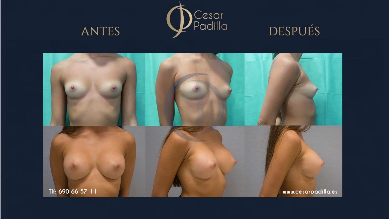 Dr. César Padilla — Cirugía Plástica y Estética en Málaga