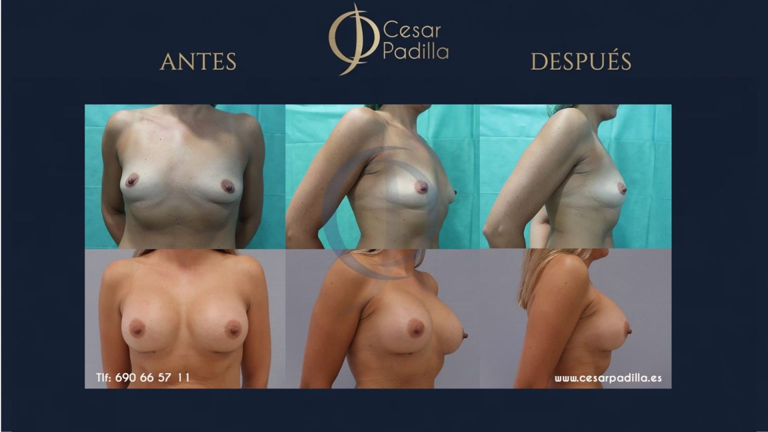 Dr. César Padilla — Cirugía Plástica y Estética en Málaga