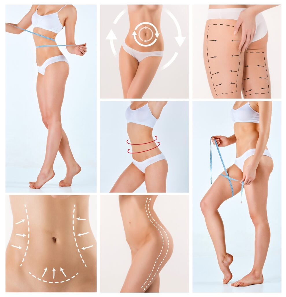 23 A Remodelación Corporal | Dr. César Padilla, Málaga