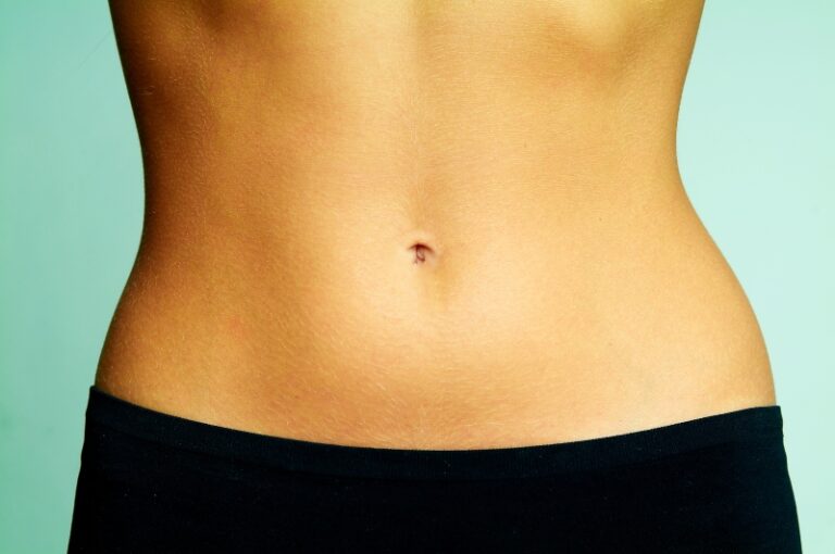 Diástasis abdominal: fotos antes y después y corrección quirúrgica