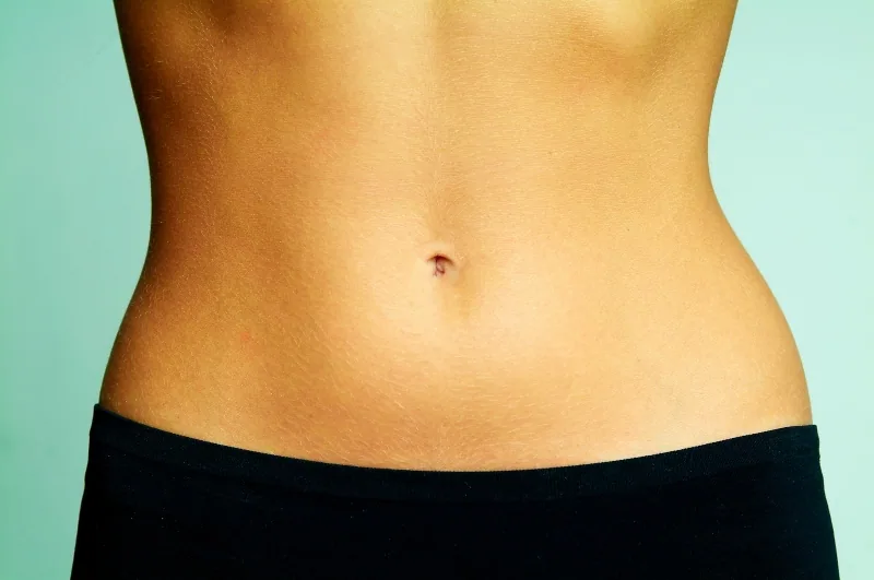 diástasis abdominal fotos antes y después
