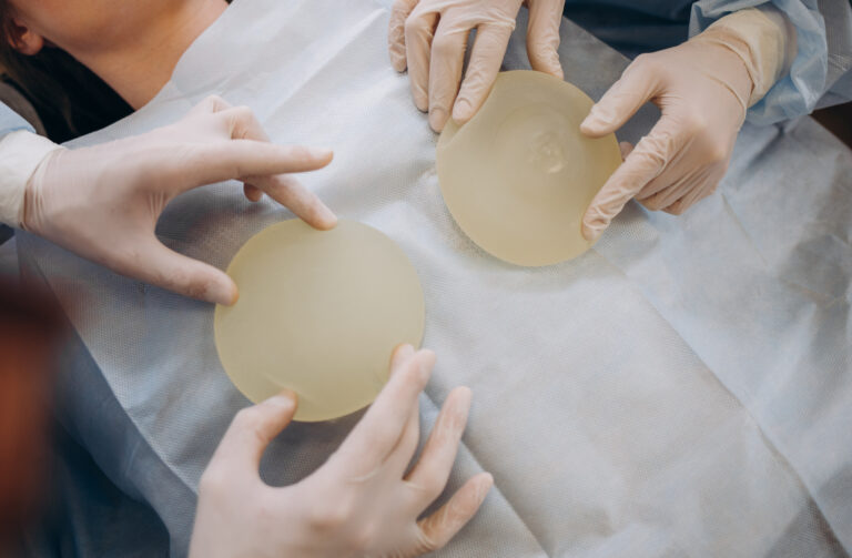 Cómo eliminar cicatrices de mastopexia: tratamientos y recomendaciones médicas