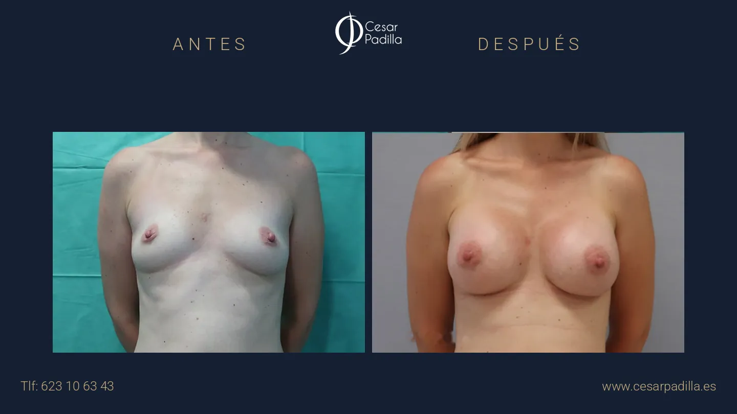 Dr. César Padilla — Cirugía Plástica y Estética en Málaga