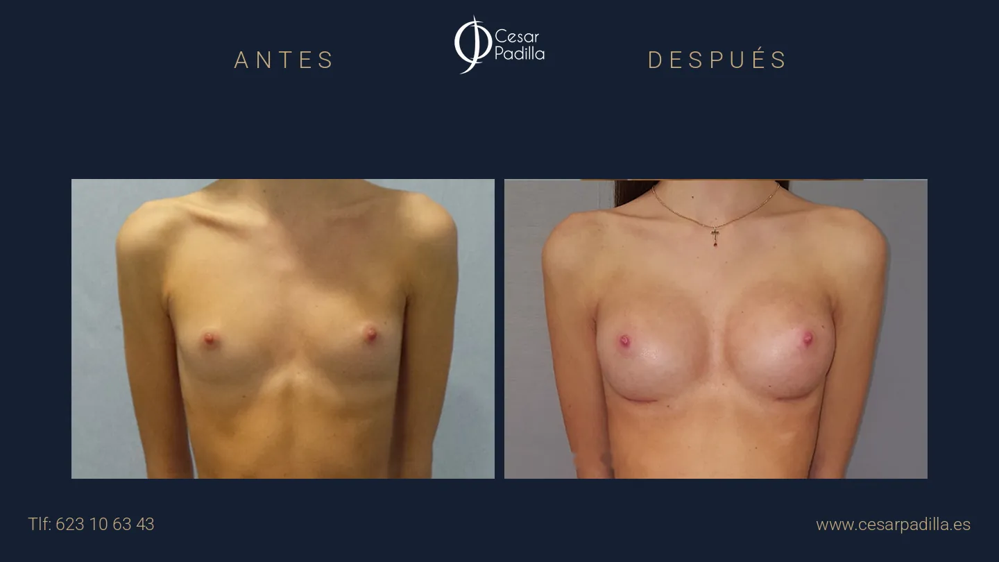 Dr. César Padilla — Cirugía Plástica y Estética en Málaga